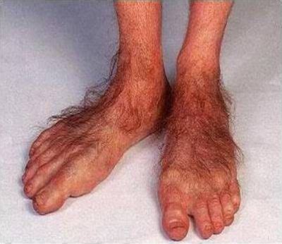 Ugly Feet Pics for Sale 